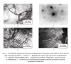 Рис. 3. Электронно-микроскопические изображения структуры стали 09Г2С после РКУП при температуре 450 °С, 4 цикла: а – ферритные зерна, светлопольное изображение; б – кар-тина микродифракции; в – перлитная колония, общий вид, светлопольное изображение; г – темнопольное изображение разрушенной перлитной колонии в рефлексе цементита
